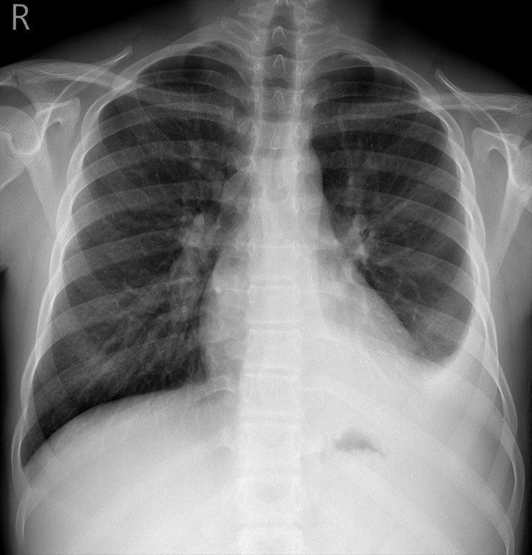 Case 11 thumbnail