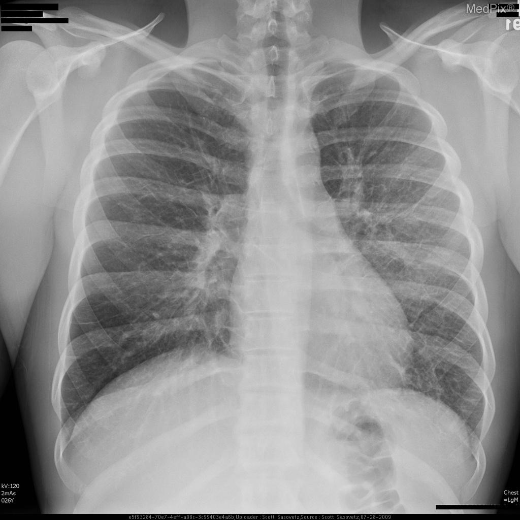 Case 5 thumbnail