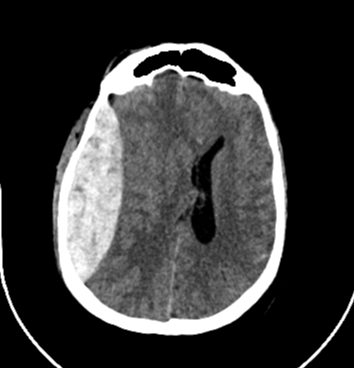 Case 5 thumbnail