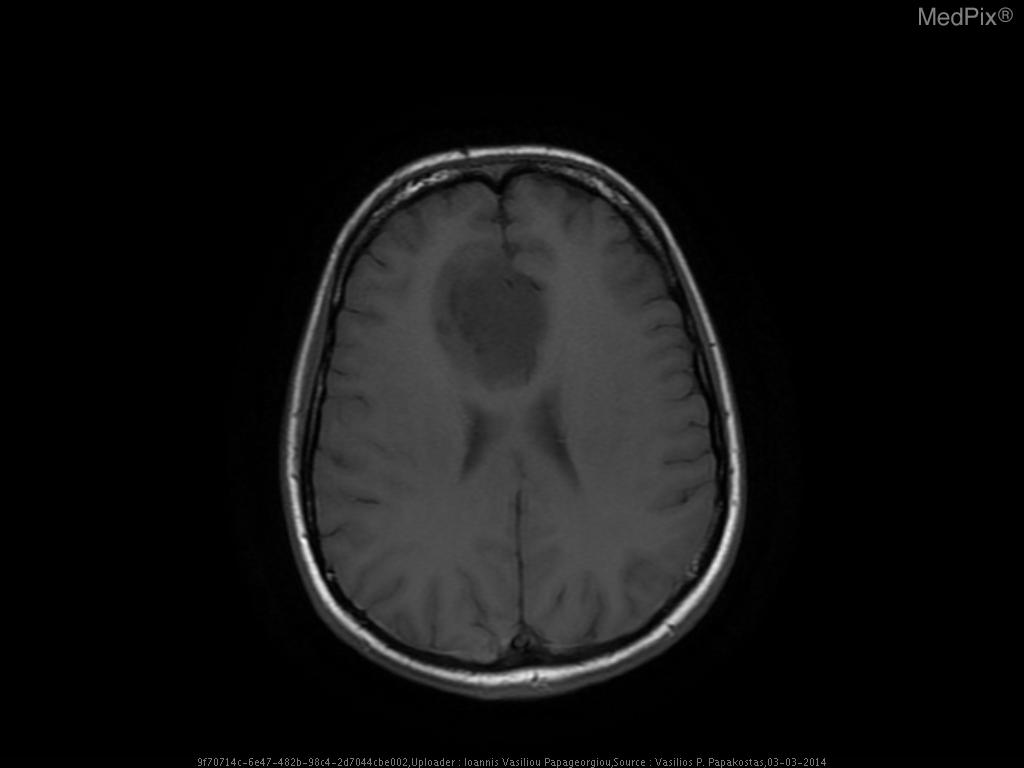 Case 6 thumbnail
