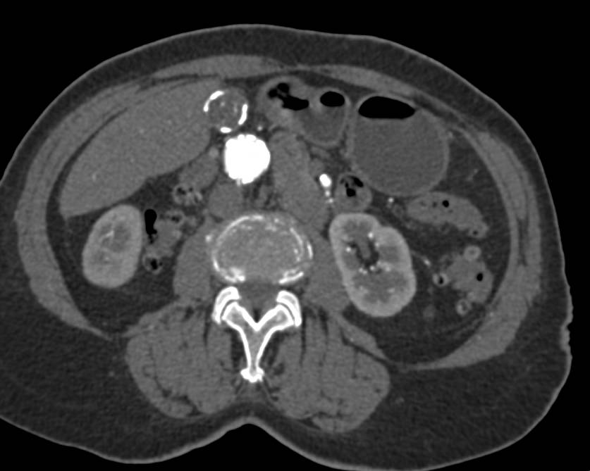 Case 6 thumbnail