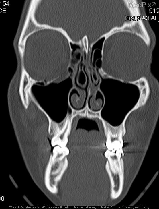 Case 8 thumbnail