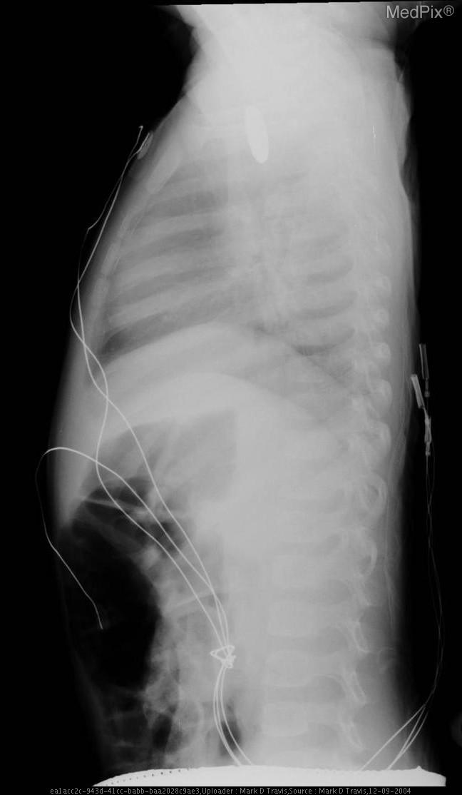 Case 9 thumbnail